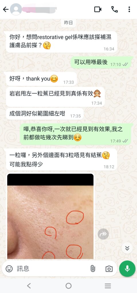 TCA家用產品改善毛孔凹凸洞，讓肌膚更光滑的效果圖